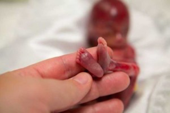 Stillborn Baby Changes Families Life Forever Photos Will Amaze You