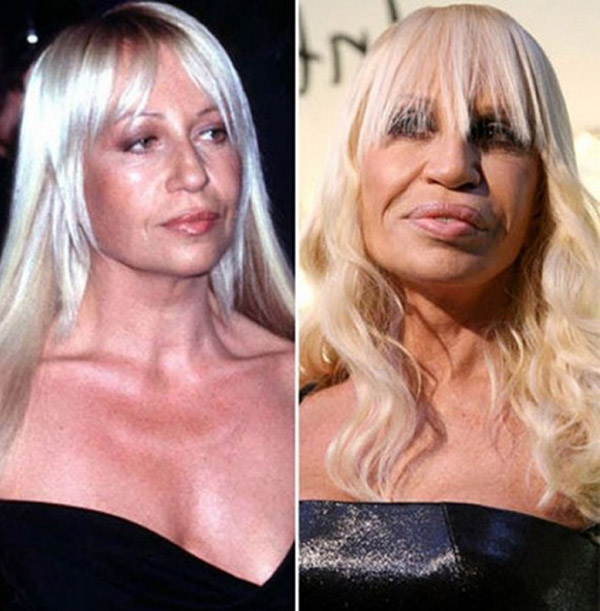 Of The Worst Plastic Surgery Fails Do They See What We See