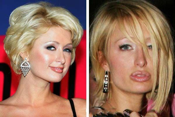 Of The Worst Plastic Surgery FAILS Do They See What We See DailyBuzzLive