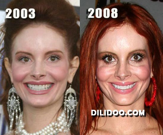 Ugly Face Plastic Surgery