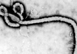 Teacher Resigns Because Parents Think She Has Ebola