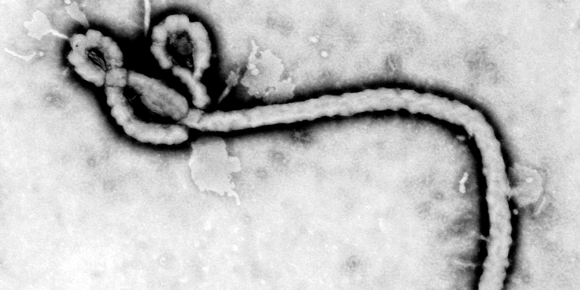 Teacher Resigns Because Parents Think She Has Ebola