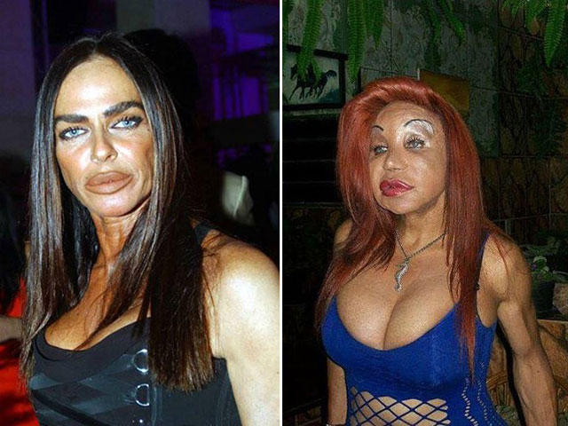 17 Of The Worst Plastic Surgery Fails Do They See What We See 