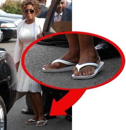 Ugliest Celebrity Body Parts - Guess Who Has These Boney Pigeon Feet